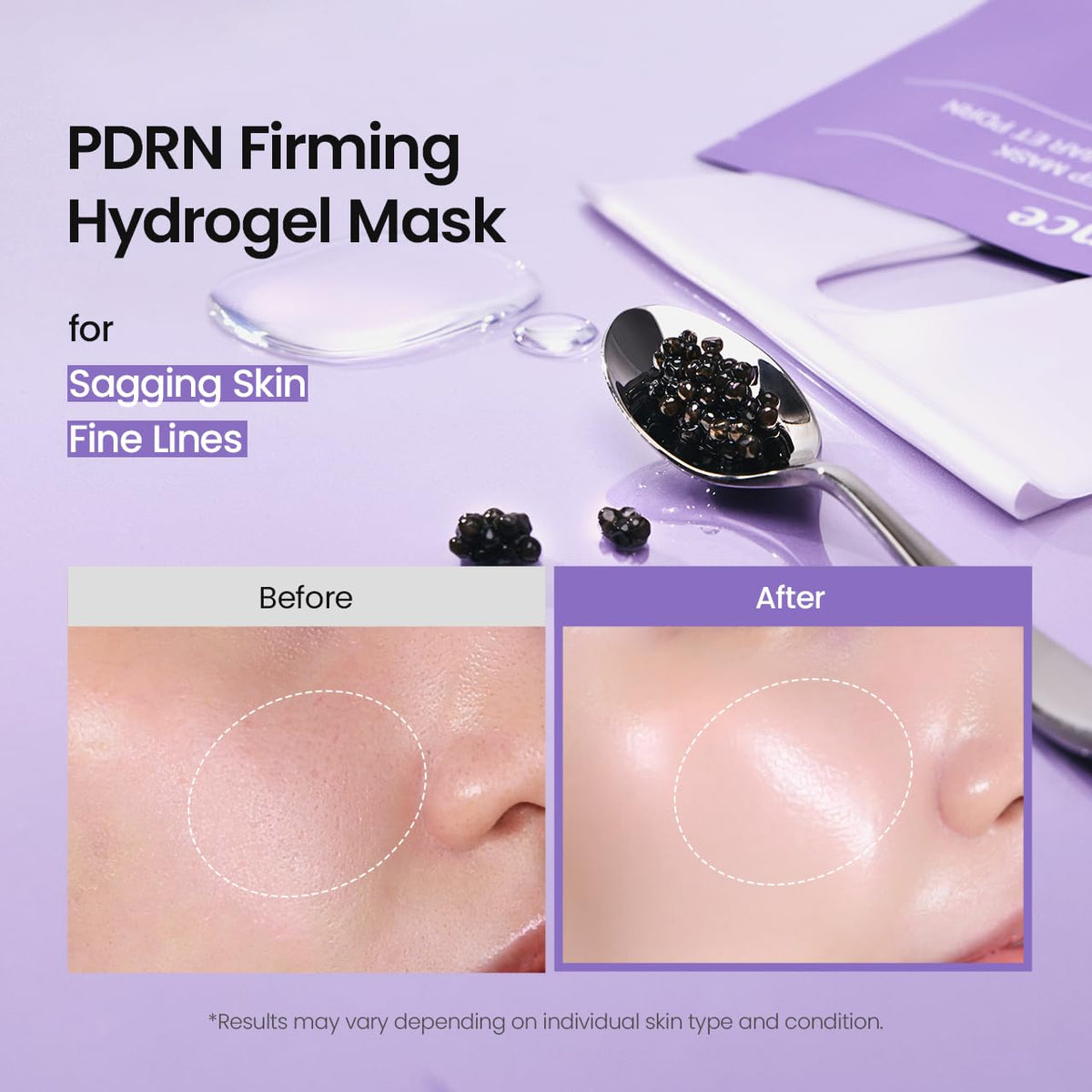 BIODANCE Bio-Collagen Real Deep, Masque Visage Hydrogel au Collagène, Masque de Nuit Hydratant, Soin des Pores et de l’Élasticité, K-Beauty Coréenne, 4 Masques